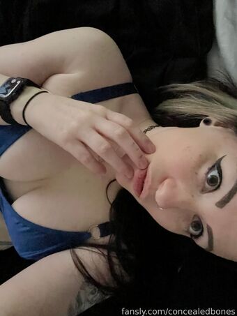 ConcealedBones