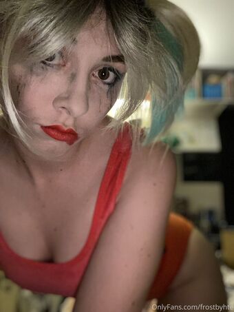 frostbyhte