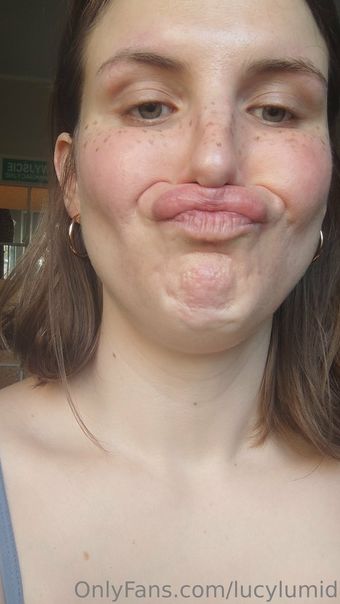 lucylumid